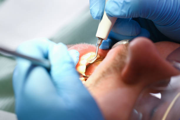Best Weekend Emergency Dentist in Brownlee Park, MI
