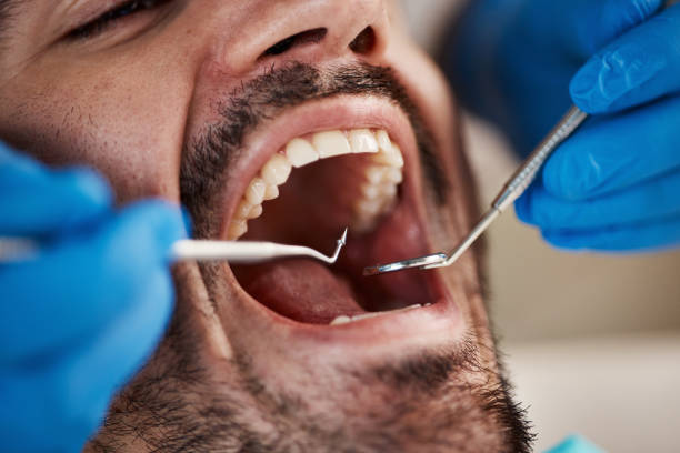 Best Emergency Treatment for Toothache in Brownlee Park, MI