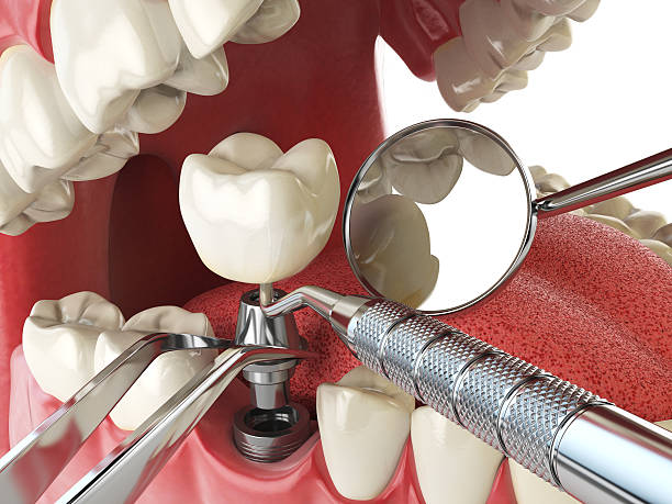 Best Walk-In Emergency Dentist in Brownlee Park, MI