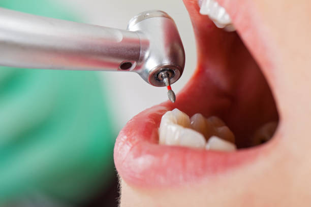Best Emergency Treatment for Toothache in Brownlee Park, MI